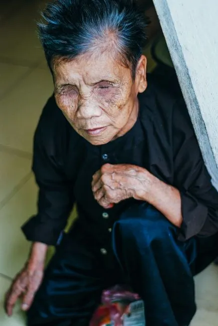 Older adult in Lafayette, Louisiana connecting with a Medicare-covered online therapist